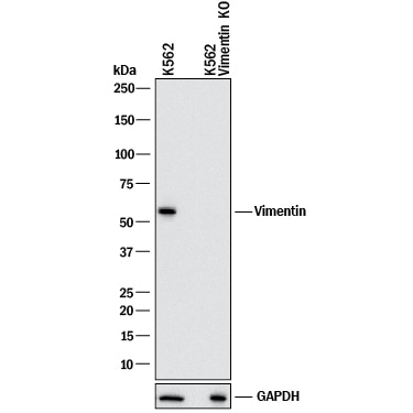 Western blot expression of Vimentin in K562 cells