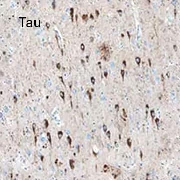Tau 
