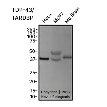 TDP-43/TARDBP Antibody