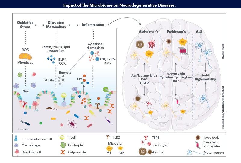 Gut Brain Axis Poster