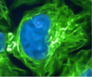 CRISPR-edited HeLa cells with fluorescent tagging of histone H1 (blue) and β-tubulin (green)