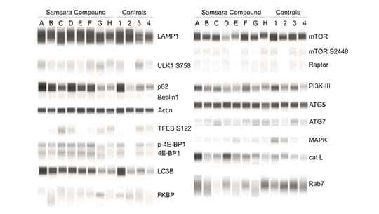 quantification and identification of potential autophagy biomarkers with Jess