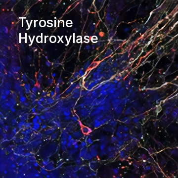 Tyrosine Hydroxylase 