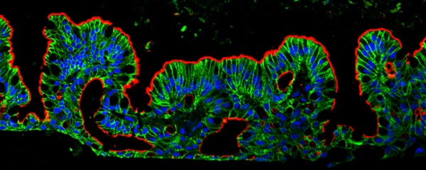 Bio-Techne receives CiteAb Researchers Choice Award 2018