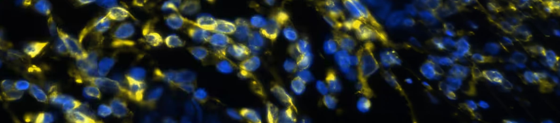COMET™ Antibody Testing Process
