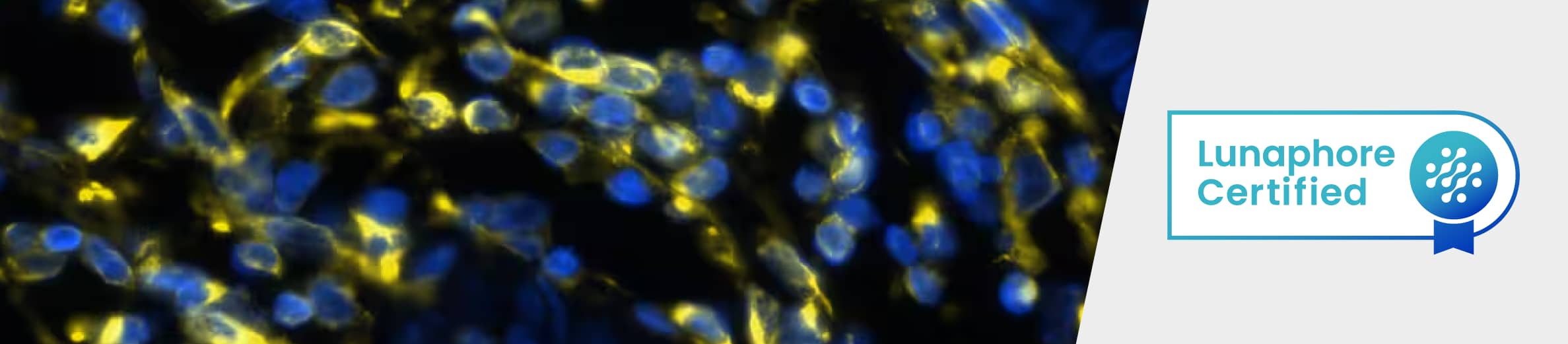 COMET™ Antibody Testing Process COMET™ Antibody Testing Process