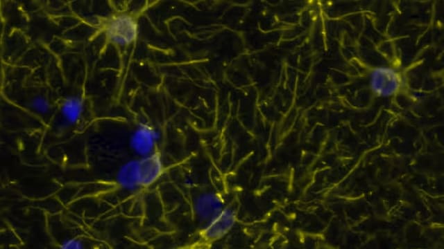 Detection of GFAP in Human Brain Cortex via Multiplex Immunofluorescence staining on COMET™