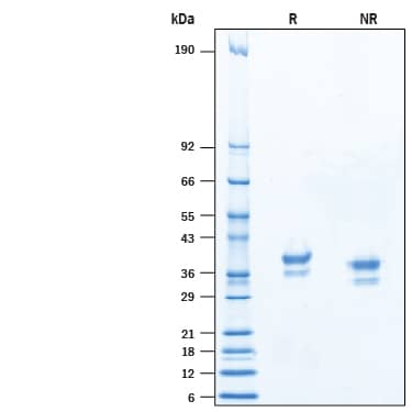 Recombinant Human IL-4 Protein 204-IL-010: R&D Systems