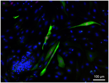 ROCK inhibition by Y-27632 and immunostaining of skeletal myogenic differentiation of MESP1+ mesoderm,