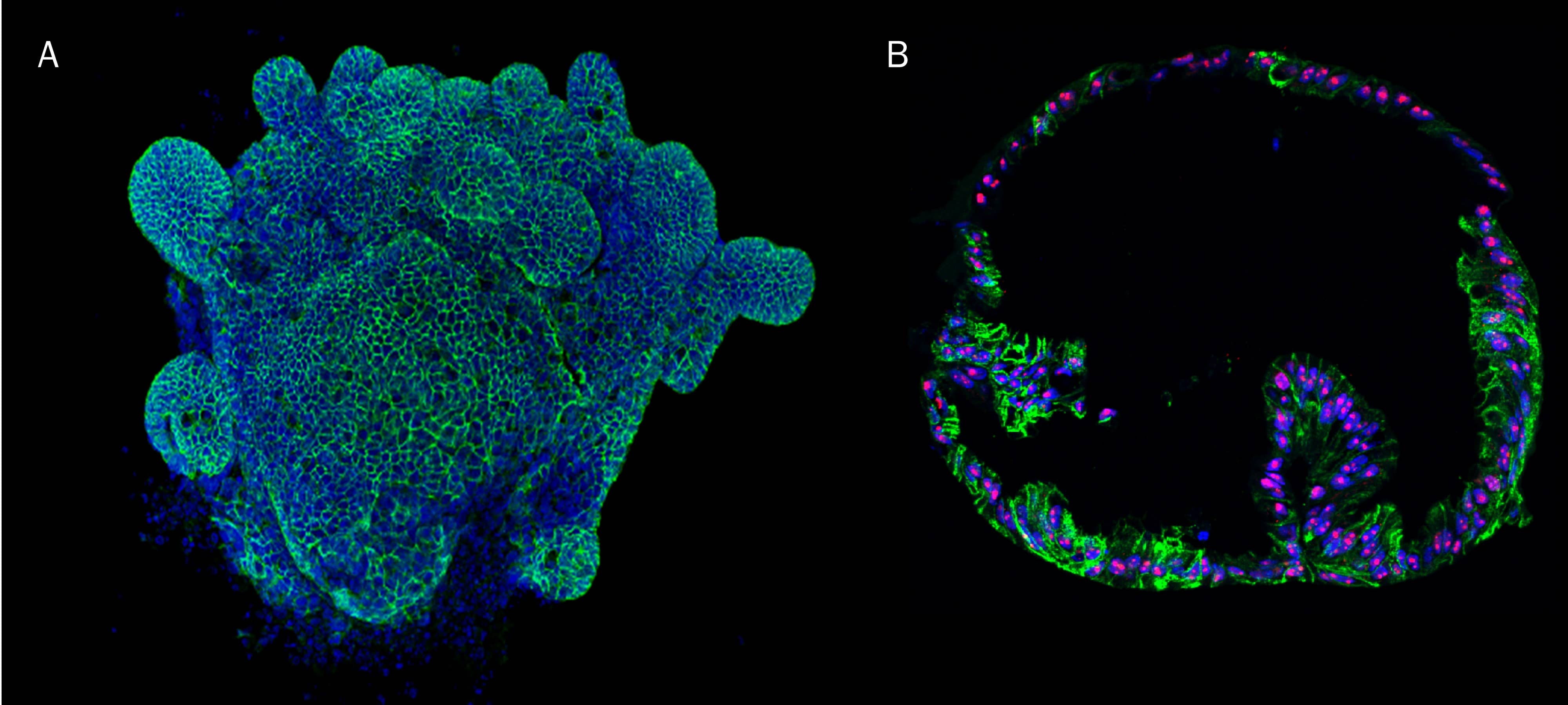 Mouse Intestinal Organoids Cultured in Cultrex RGF BME Type 2_3533-005-02