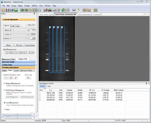 I need to do analyses like densitometry and total protein normalization