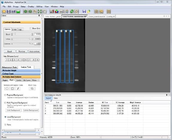 I need to do analyses like densitometry and total protein normalization