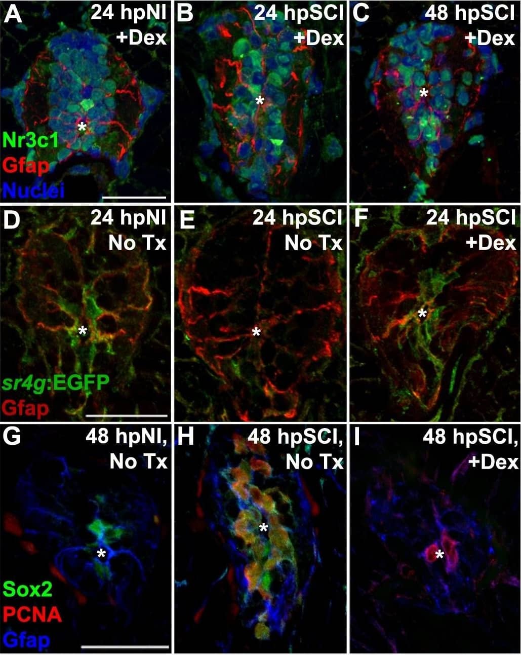 Human/Mouse/Rat SOX2 Antibody (AF2018): 195+ Citations: R&D Systems