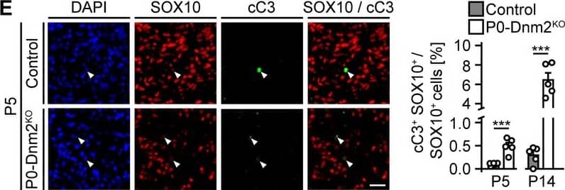 パンフレット D.N.A DNA aptamer targeting zinc transporters ZIP10 and ZIP6 on