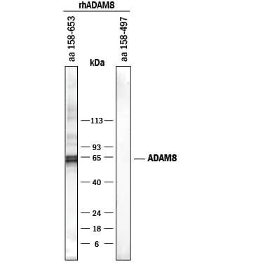 Detection of Human ADAM8 antibody by Western Blot.