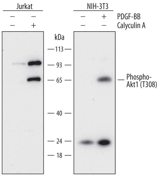 Detection of Human and Mouse Phospho-Akt1 (T308) antibody by Western Blot.