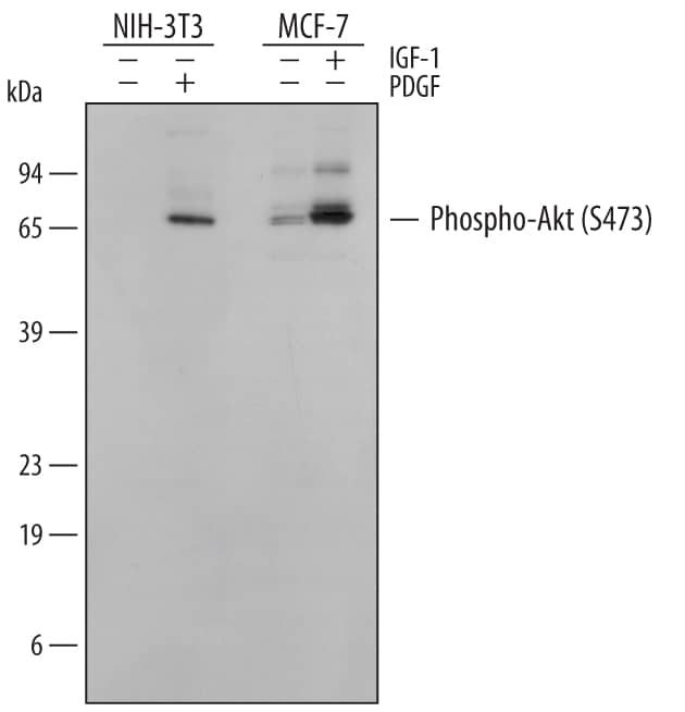 Detection of Mouse and Human Phospho-Akt (S473) Pan Specific antibody by Western Blot.