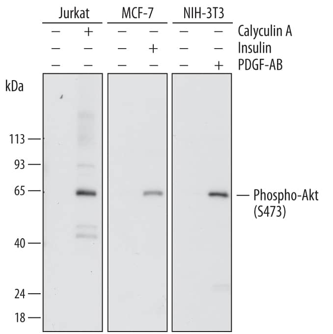 Detection of Human and Mouse Phospho-Akt (S473) antibody by Western Blot.