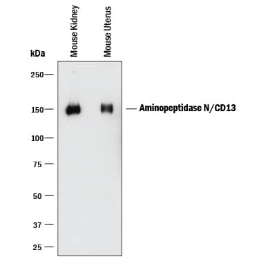 Detection of Mouse Aminopeptidase N/CD13 antibody by Western Blot.