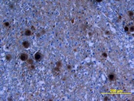 BDNF Purified R&D Systems antibody anti target:Human, Mouse, Rat, Xenopus, Zebrafish host:Chicken isotype:IgY clone: BDNF in Human Spinal Cord. BDNF was detected in immersion fixed paraffin-embedded sections of hum...