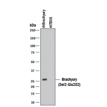 Detection of Recombinant Human Brachyury antibody by Western Blot.