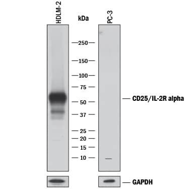 Detection of Human CD25/IL-2R alpha antibody by Western Blot.