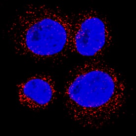 CD36/SR-B3 antibody in U937 Human Cell Line by Immunocytochemistry (ICC).