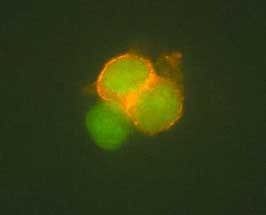 CD4 antibody in Human T Cells by Immunocytochemistry (ICC).