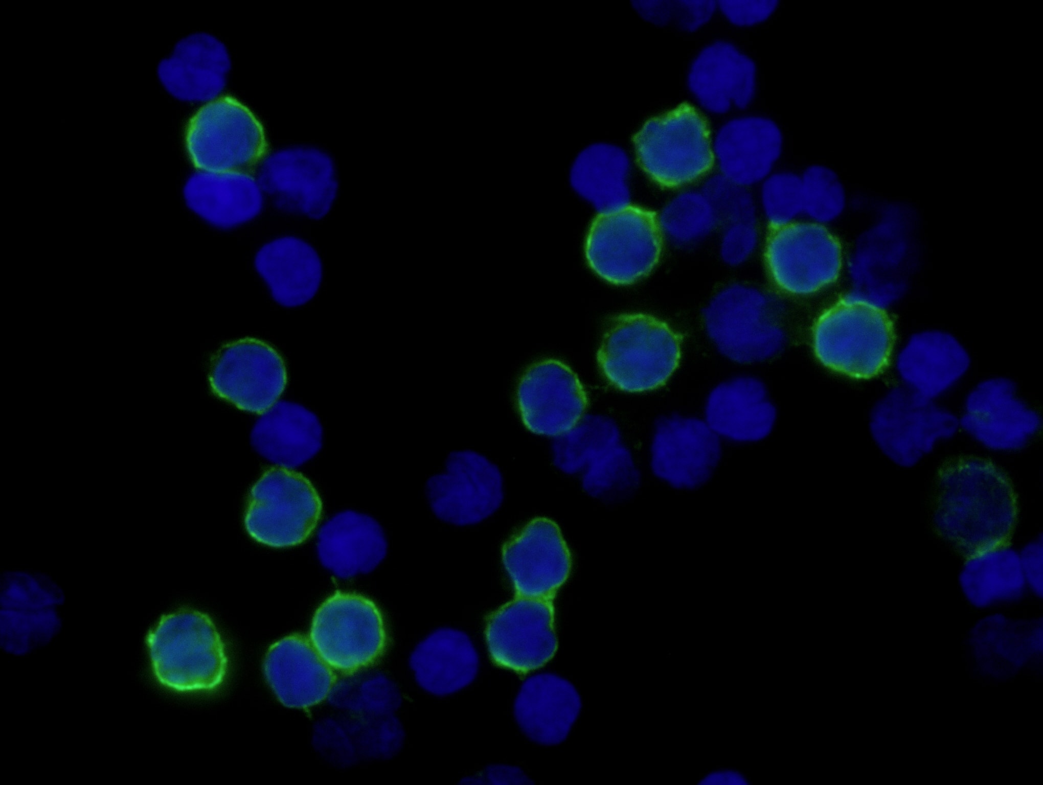 CD4 antibody in Human PBMCs by Immunocytochemistry (ICC).