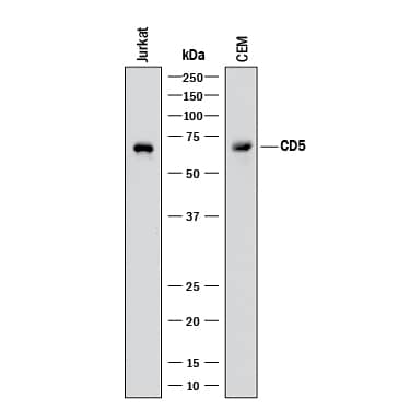 Detection of Human CD5 antibody by Western Blot.