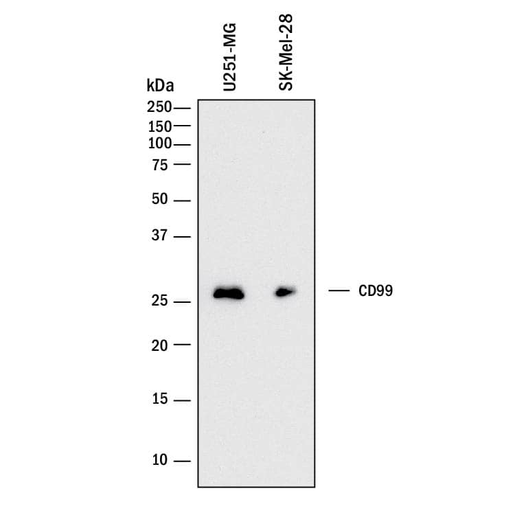 Detection of Human CD99 antibody by Western Blot.