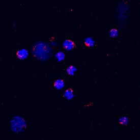 CXCL2/GRO beta /MIP-2/CINC-3 antibody in Mouse Splenocytes by Immunocytochemistry (ICC).