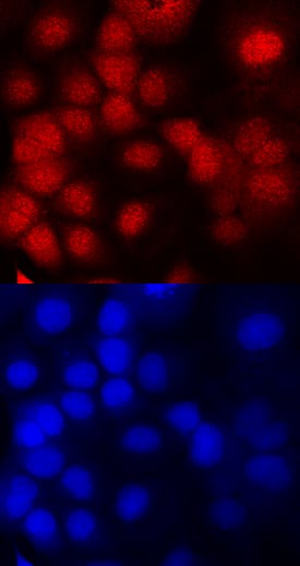 DNMT3A antibody in OVCAR-3 Human Cell Line by Immunocytochemistry (ICC).