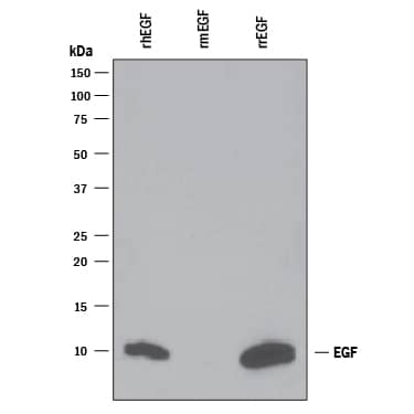 Detection of Recombinant Human and Rat EGF antibody by Western Blot.