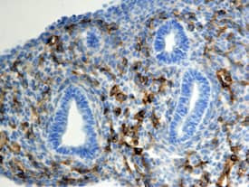 Endoglin/CD105 antibody in Mouse Lung by Immunohistochemistry (IHC-Fr).