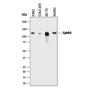 Detection of Human EphB4 antibody by Western Blot.