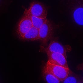 ErbB4/Her4 antibody in MCF-7 Human Cell Line by Immunocytochemistry (ICC).