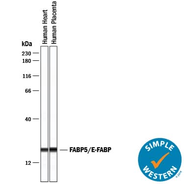 Anti-Brain lipid binding protein Antibody from rabbit, purified by affinity  chromatography