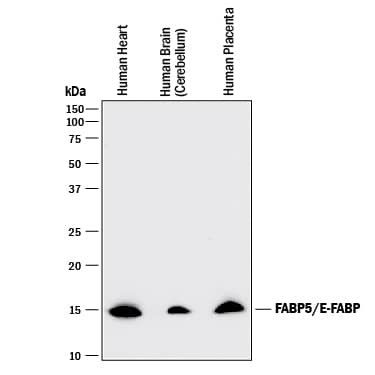 Anti-Brain lipid binding protein Antibody from rabbit, purified by affinity  chromatography