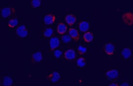 Flt&#x2011;3/Flk&#x2011;2 antibody in M1 Mouse Cell Line by Immunocytochemistry (ICC).