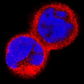 IL-15 Ra antibody in HDLM-2 Human Cell Line by Immunocytochemistry (ICC).