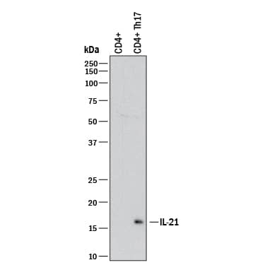 Detection of Human IL-21 antibody by Western Blot.