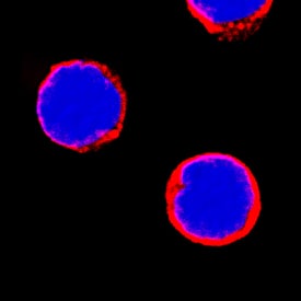 MMR/CD206 antibody in Human PBMCs by Immunocytochemistry (ICC).