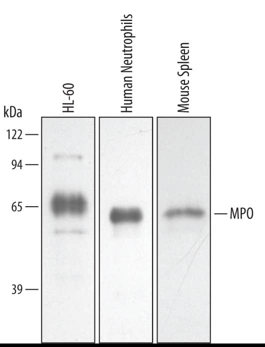 Detection of Human/Mouse Myeloperoxidase/MPO antibody by Western Blot.