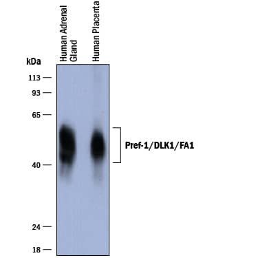 Detection of Human Pref-1/DLK1/FA1 antibody by Western Blot.