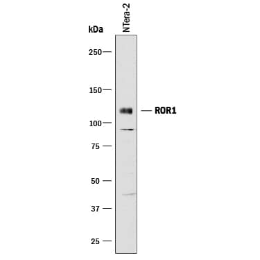 Detection of ROR1 antibody by Western Blot.