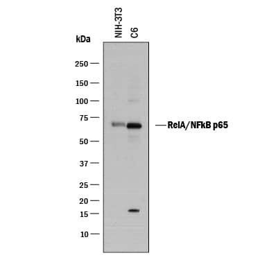 Western blots show p65 antibodies that passed the test of specificity