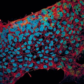 E-Cadherin and SOX2 antibody in BG01V Human Stem Cells by Immunocytochemistry (ICC).