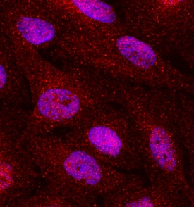 Human Phospho-Smad2 (S465/S467)/Smad3 (S423/S425) Antibody AB3226: R&D ...