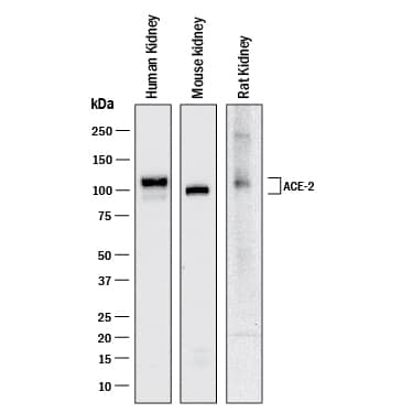 Detection of Human, Mouse, and Rat ACE&#x2011;2 antibody by Western Blot.